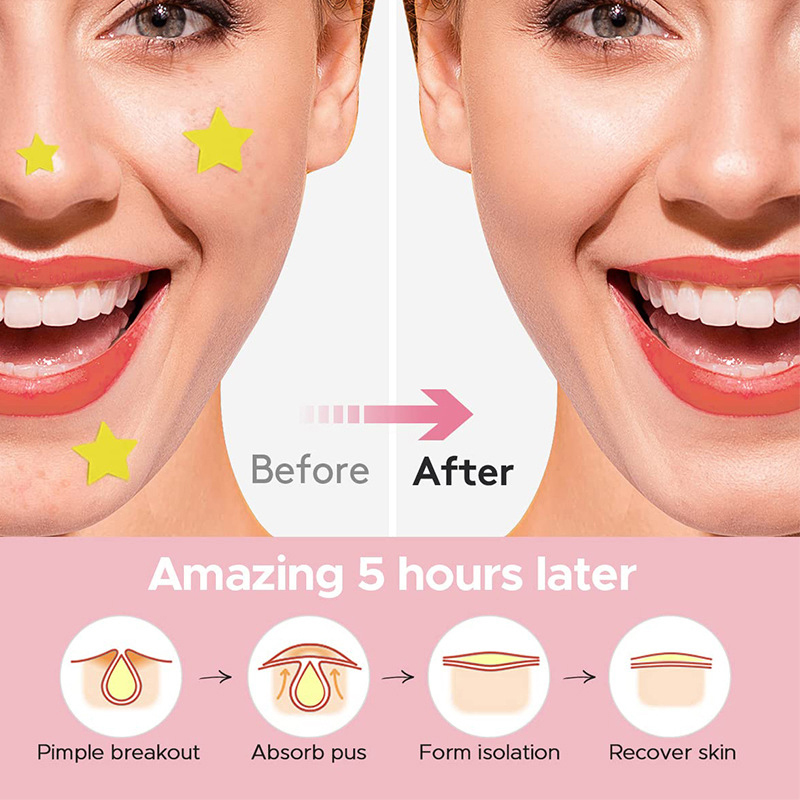 600Pcs/set Star Pimple Patch A - Beauty In Makeup recension och pris